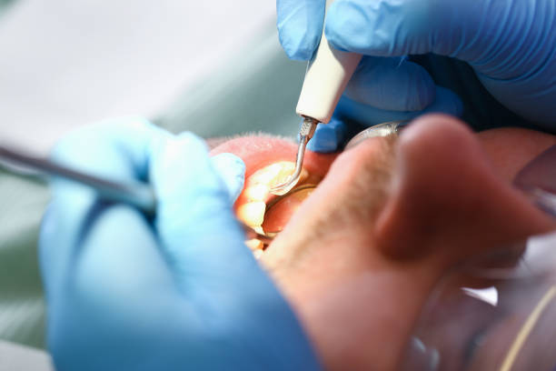 Best Emergency Treatment for Dental Infections or Abscesses in Skyline Acres, OH